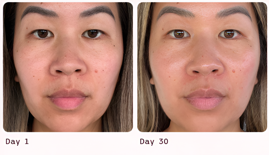 4-in-1 Red Light Therapy Wand & Activating Serum Kit